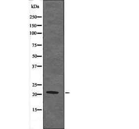 Western blot - Claudin 4 (Phospho-Tyr208) Antibody from Signalway Antibody (12587) - Antibodies.com