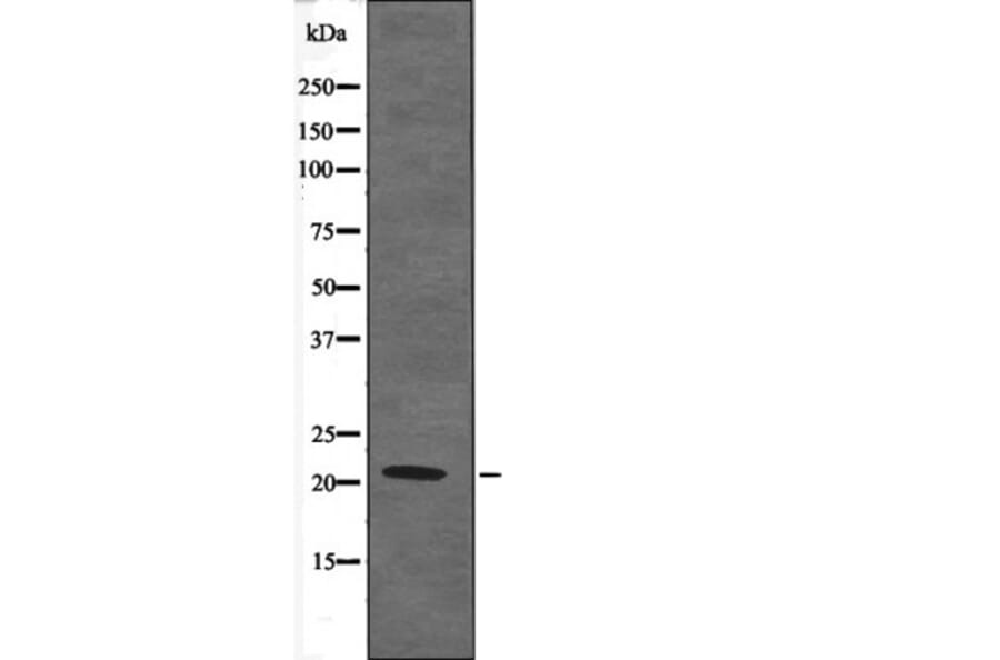 Western blot - Claudin 4 (Phospho-Tyr208) Antibody from Signalway Antibody (12587) - Antibodies.com