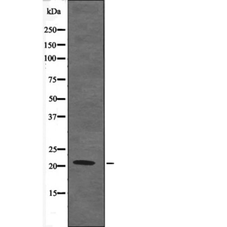 Western blot - Claudin 4 (Phospho-Tyr208) Antibody from Signalway Antibody (12587) - Antibodies.com