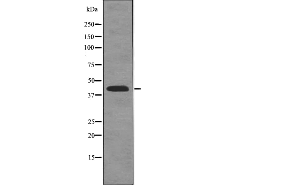 Western blot - Rad2/FEN1 (Phospho-Ser187) Antibody from Signalway Antibody (12777) - Antibodies.com