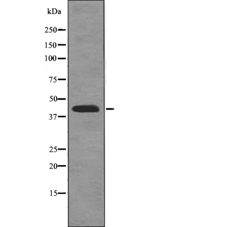 Western blot - Rad2/FEN1 (Phospho-Ser187) Antibody from Signalway Antibody (12777) - Antibodies.com