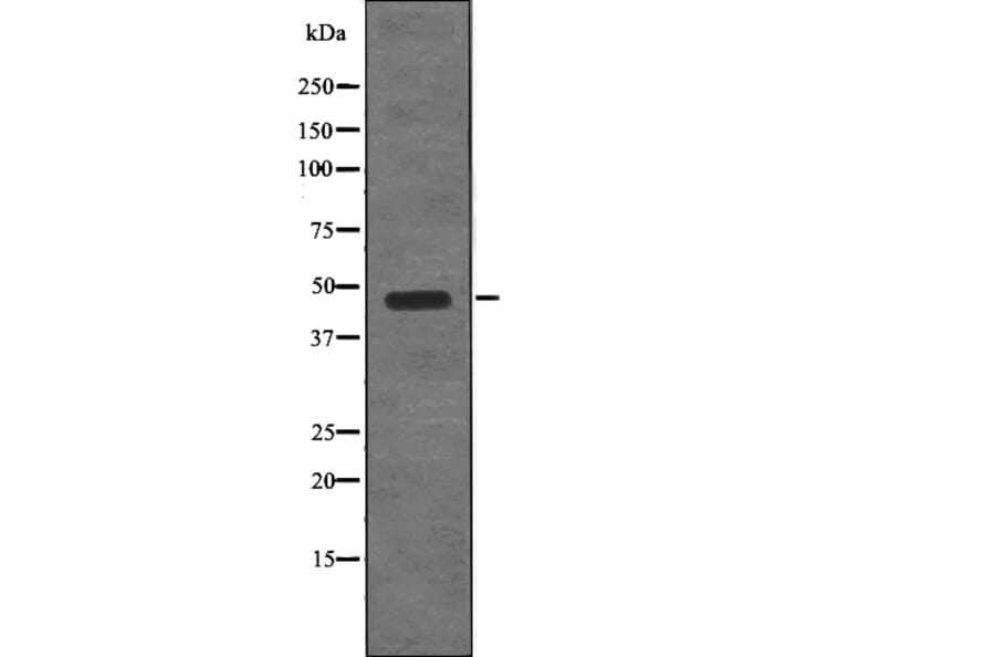 Western blot - STYK1/NOK (Phospho-Tyr327) Antibody from Signalway Antibody (12783) - Antibodies.com