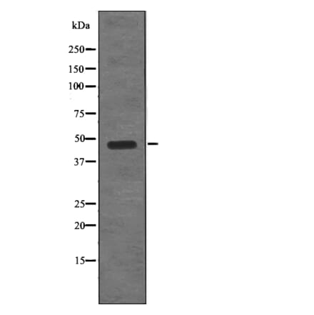 Western blot - STYK1/NOK (Phospho-Tyr327) Antibody from Signalway Antibody (12783) - Antibodies.com