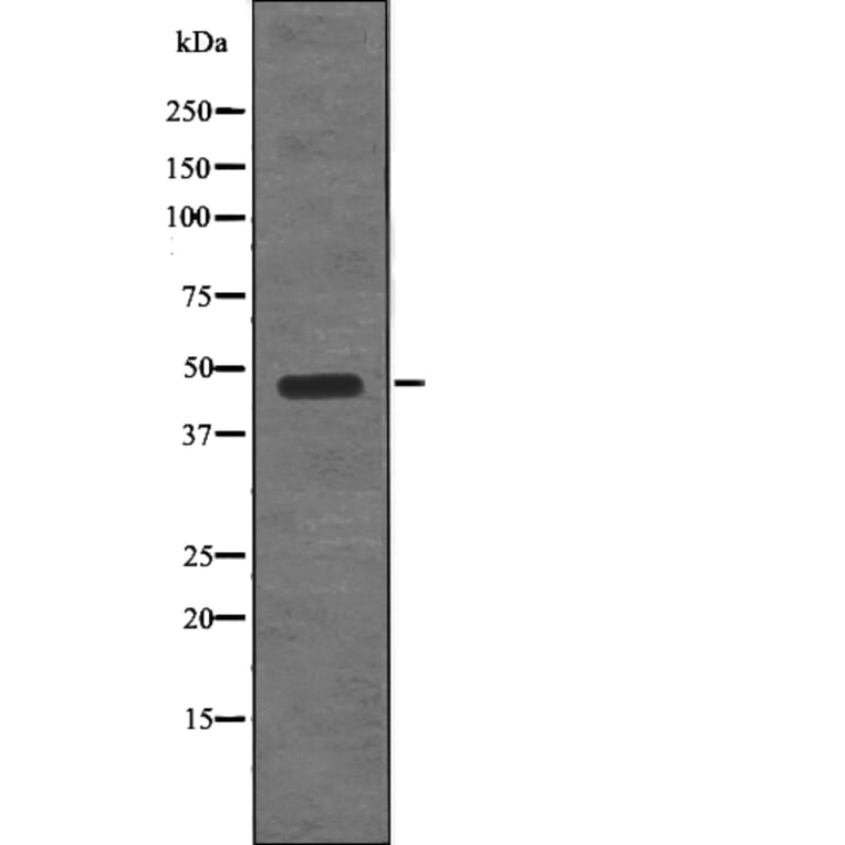Western blot - STYK1/NOK (Phospho-Tyr327) Antibody from Signalway Antibody (12783) - Antibodies.com