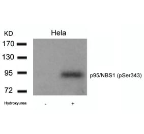Western blot - p95/NBS1 (Phospho-Ser343) Antibody from Signalway Antibody (11057) - Antibodies.com