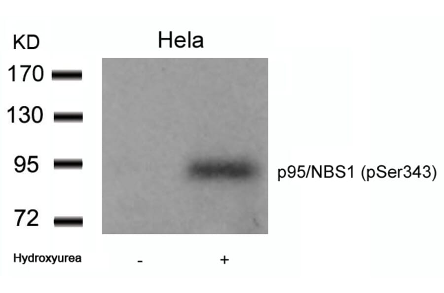 Western blot - p95/NBS1 (Phospho-Ser343) Antibody from Signalway Antibody (11057) - Antibodies.com