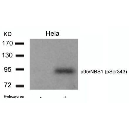 Western blot - p95/NBS1 (Phospho-Ser343) Antibody from Signalway Antibody (11057) - Antibodies.com