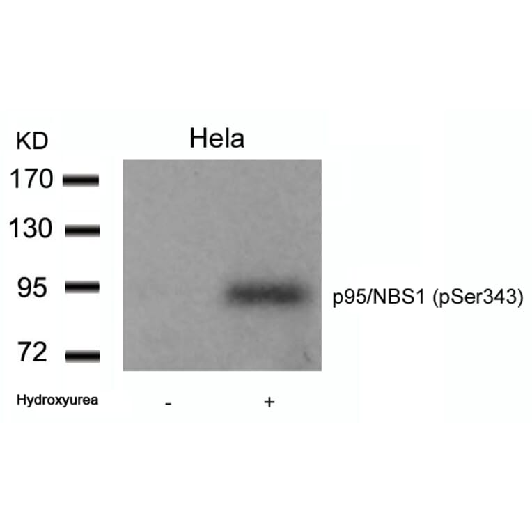 Western blot - p95/NBS1 (Phospho-Ser343) Antibody from Signalway Antibody (11057) - Antibodies.com