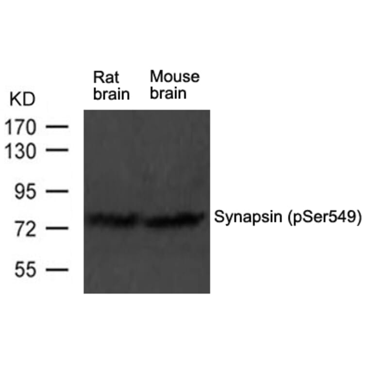 Western blot - Synapsin (phospho-Ser549) Antibody from Signalway Antibody (11568) - Antibodies.com