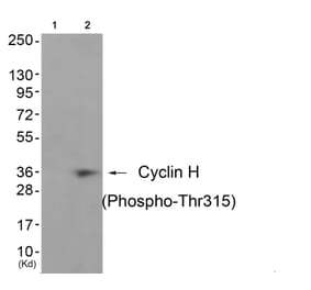 Western blot - Cyclin H (Phospho-Thr315) Antibody from Signalway Antibody (11689) - Antibodies.com