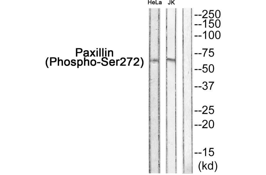 Western blot - Paxillin (Phospho-Ser272) Antibody from Signalway Antibody (11762) - Antibodies.com
