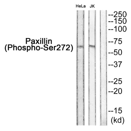 Western blot - Paxillin (Phospho-Ser272) Antibody from Signalway Antibody (11762) - Antibodies.com