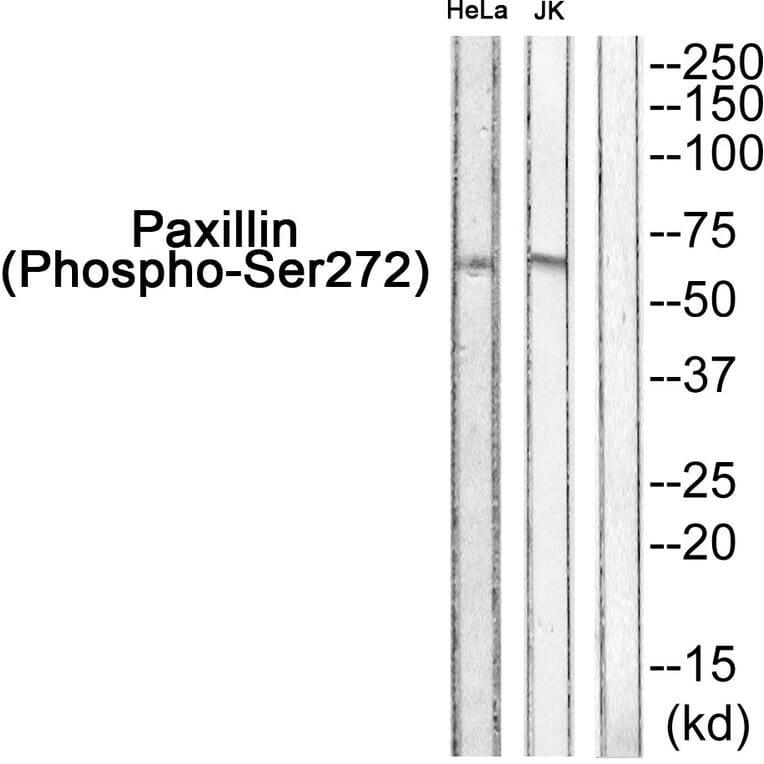 Western blot - Paxillin (Phospho-Ser272) Antibody from Signalway Antibody (11762) - Antibodies.com