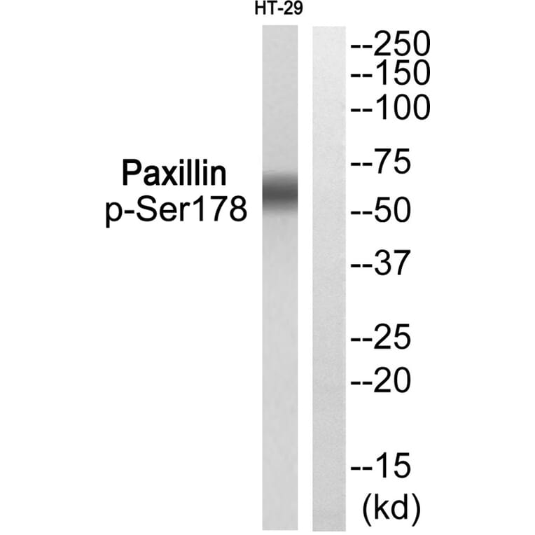Western blot - Paxillin (Phospho-Ser178) Antibody from Signalway Antibody (11773) - Antibodies.com