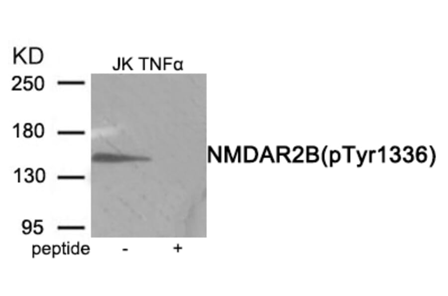 Western blot - NMDAR2B (Phospho-Tyr1336) Antibody from Signalway Antibody (11959) - Antibodies.com