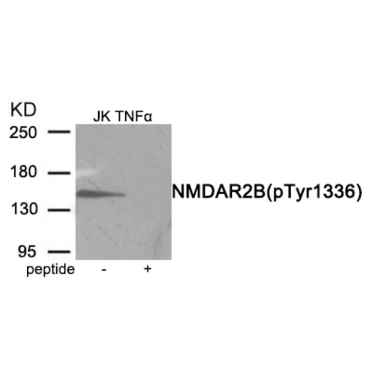 Western blot - NMDAR2B (Phospho-Tyr1336) Antibody from Signalway Antibody (11959) - Antibodies.com