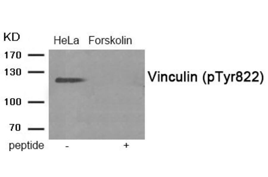 Western blot - Vinculin (Phospho-Tyr822) Antibody from Signalway Antibody (11973) - Antibodies.com