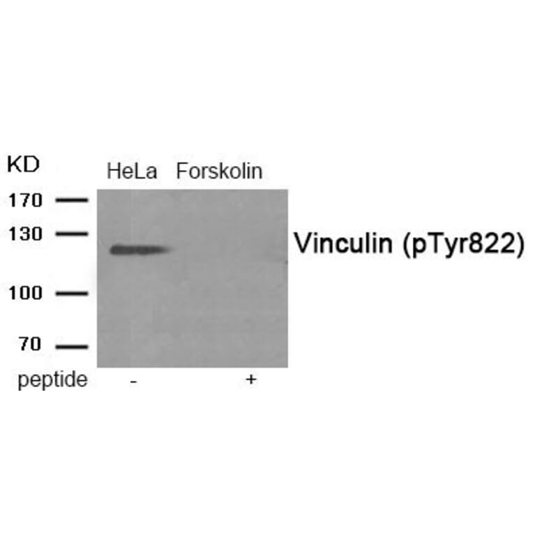 Western blot - Vinculin (Phospho-Tyr822) Antibody from Signalway Antibody (11973) - Antibodies.com