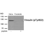 Western blot - Vinculin (Phospho-Tyr822) Antibody from Signalway Antibody (11973) - Antibodies.com