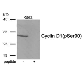 Western blot - Cyclin D1 (Phospho-Ser90) Antibody from Signalway Antibody (11986) - Antibodies.com