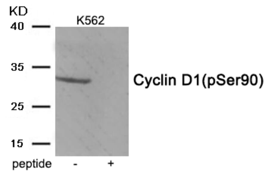 Western blot - Cyclin D1 (Phospho-Ser90) Antibody from Signalway Antibody (11986) - Antibodies.com