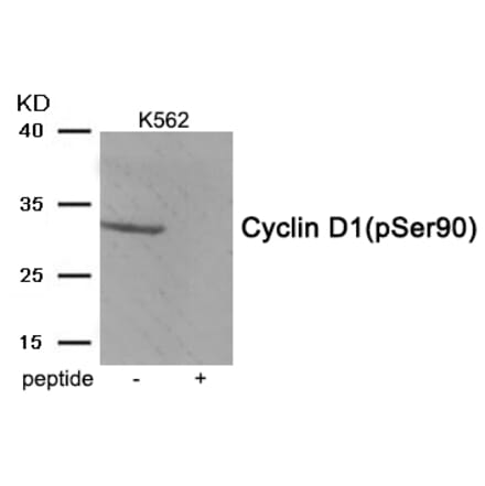 Western blot - Cyclin D1 (Phospho-Ser90) Antibody from Signalway Antibody (11986) - Antibodies.com