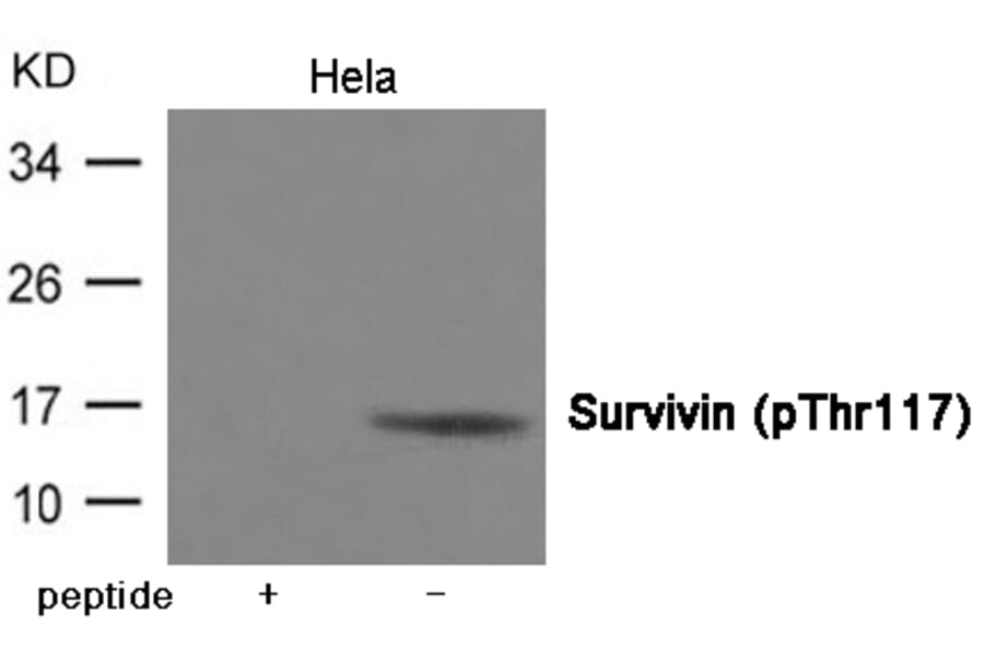 Western blot - Survivin (Phospho-Thr117) Antibody from Signalway Antibody (12026) - Antibodies.com