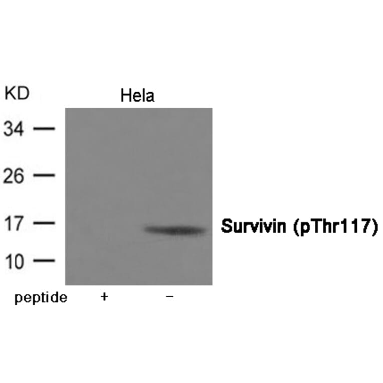 Western blot - Survivin (Phospho-Thr117) Antibody from Signalway Antibody (12026) - Antibodies.com