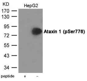 Western blot - Ataxin 1 (Phospho-Ser776) Antibody from Signalway Antibody (12034) - Antibodies.com