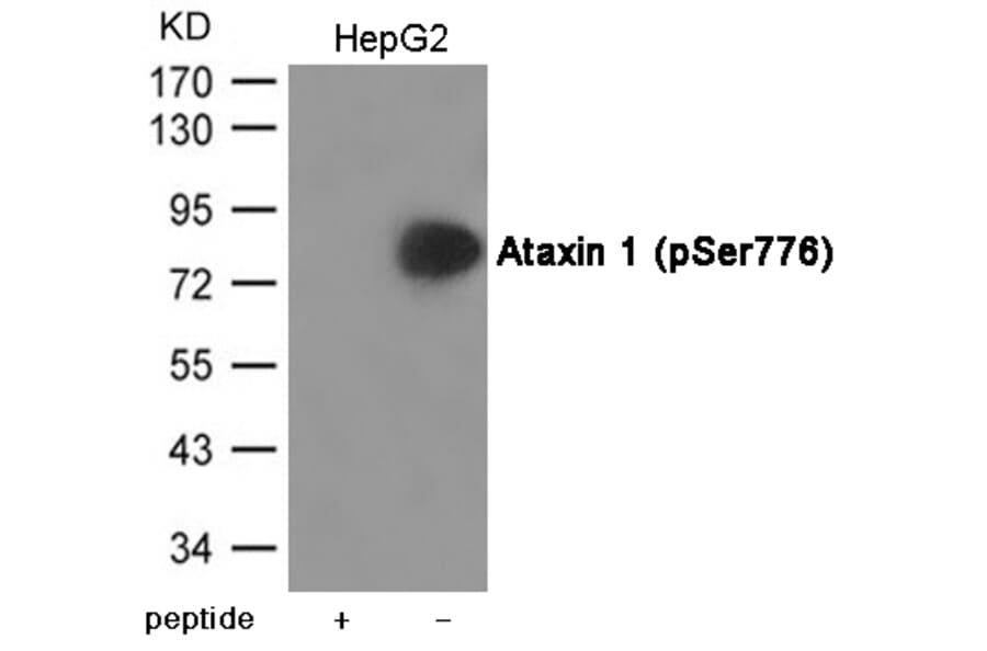 Western blot - Ataxin 1 (Phospho-Ser776) Antibody from Signalway Antibody (12034) - Antibodies.com