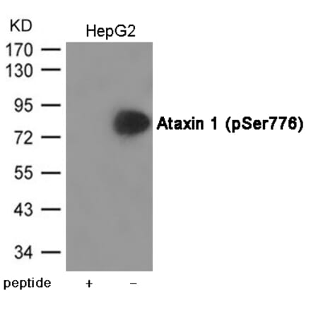 Western blot - Ataxin 1 (Phospho-Ser776) Antibody from Signalway Antibody (12034) - Antibodies.com