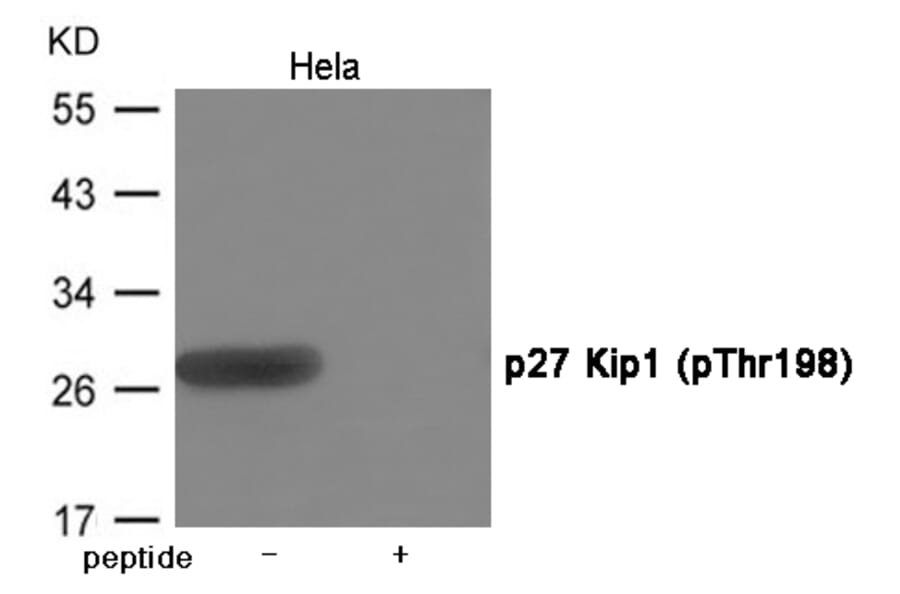 Western blot - p27 Kip1 (Phospho-Thr198) Antibody from Signalway Antibody (12047) - Antibodies.com