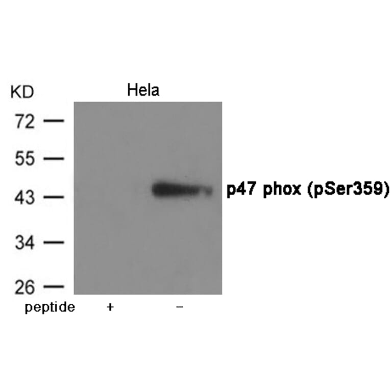 Western blot - p47 phox (Phospho-Ser359) Antibody from Signalway Antibody (12054) - Antibodies.com