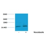 Western blot - Histone H3 (Phospho-Ser10) Rabbit Polyclonal Antibody from Signalway Antibody - Antibodies.com