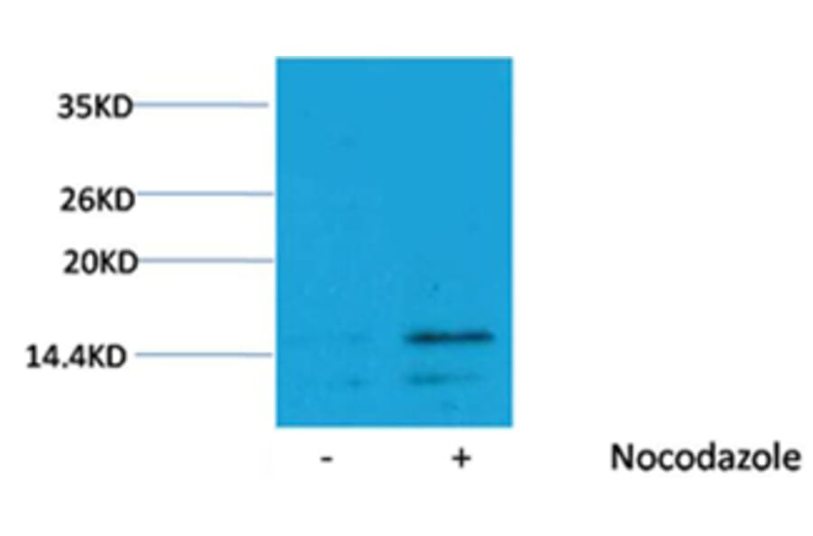 Western blot - Histone H3 (Phospho-Ser28) Rabbit Polyclonal Antibody from Signalway Antibody - Antibodies.com