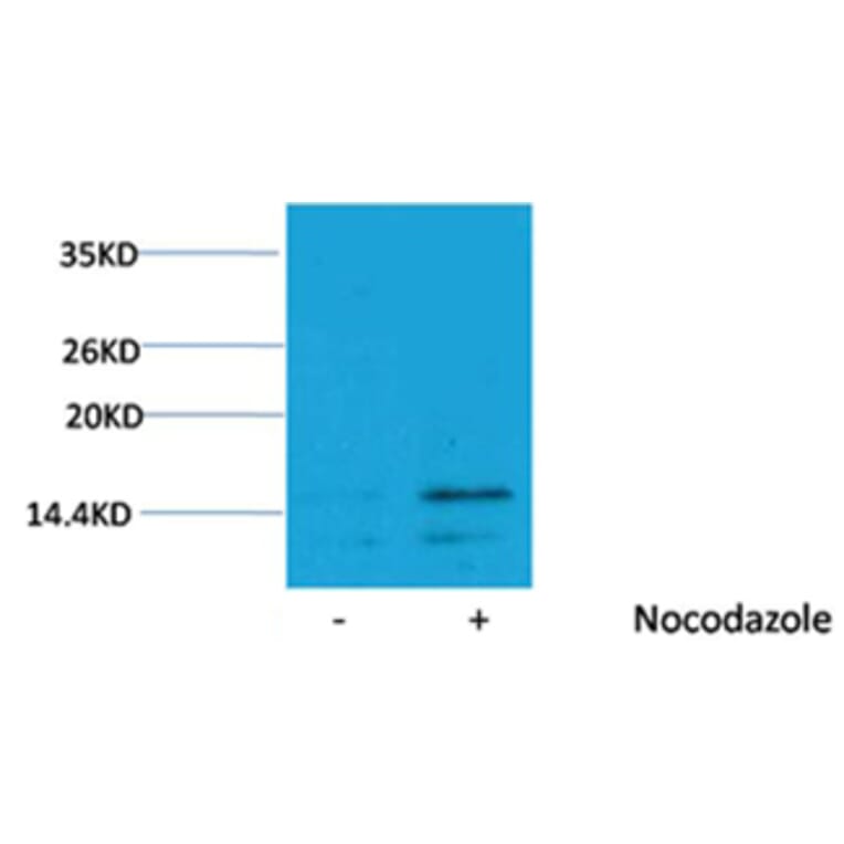 Western blot - Histone H3 (Phospho-Ser28) Rabbit Polyclonal Antibody from Signalway Antibody - Antibodies.com