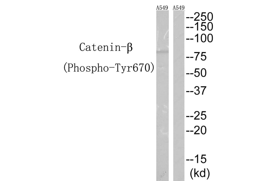 Western blot - Catenin-β (Phospho-Tyr670) Antibody from Signalway Antibody (12114) - Antibodies.com