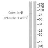 Western blot - Catenin-β (Phospho-Tyr670) Antibody from Signalway Antibody (12114) - Antibodies.com
