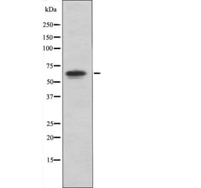 Western blot - PAK4/5/6 (Phospho-Ser474) Antibody from Signalway Antibody (12417) - Antibodies.com