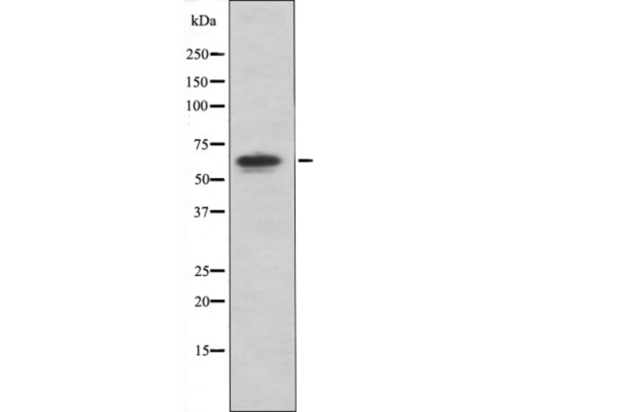 Western blot - PAK4/5/6 (Phospho-Ser474) Antibody from Signalway Antibody (12417) - Antibodies.com