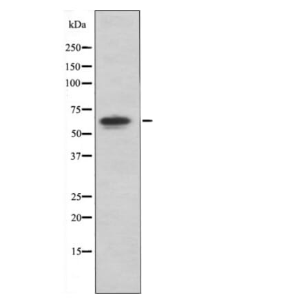 Western blot - PAK4/5/6 (Phospho-Ser474) Antibody from Signalway Antibody (12417) - Antibodies.com