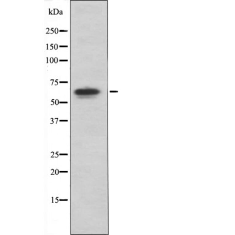 Western blot - PAK4/5/6 (Phospho-Ser474) Antibody from Signalway Antibody (12417) - Antibodies.com