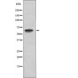 Western blot - PAK4/5/6 (Phospho-Ser474) Antibody from Signalway Antibody (12417) - Antibodies.com