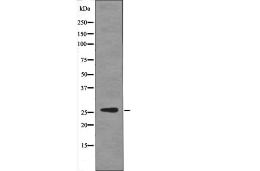 Western blot - p27 Kip1 (Phospho-Ser178) Antibody from Signalway Antibody (12430) - Antibodies.com