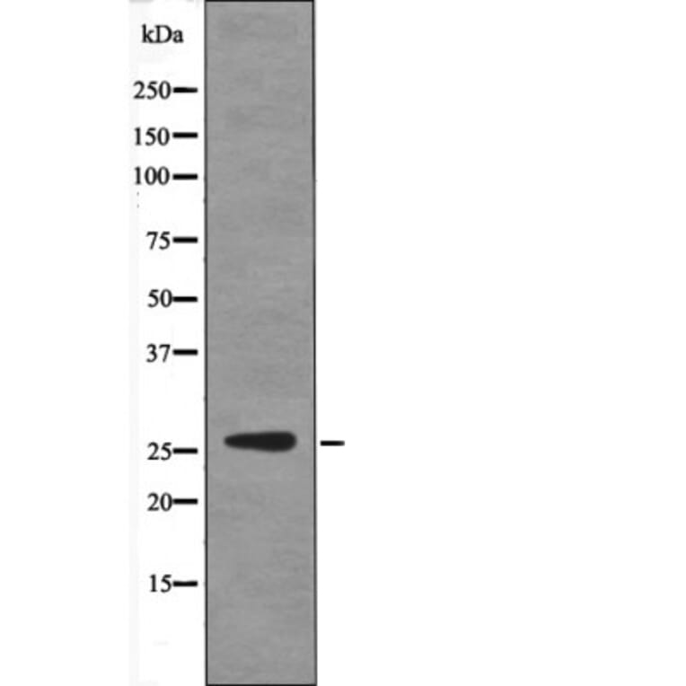 Western blot - p27 Kip1 (Phospho-Ser178) Antibody from Signalway Antibody (12430) - Antibodies.com