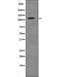 Western blot - ANKRD28 (Phospho-Ser1040) Antibody from Signalway Antibody (12571) - Antibodies.com