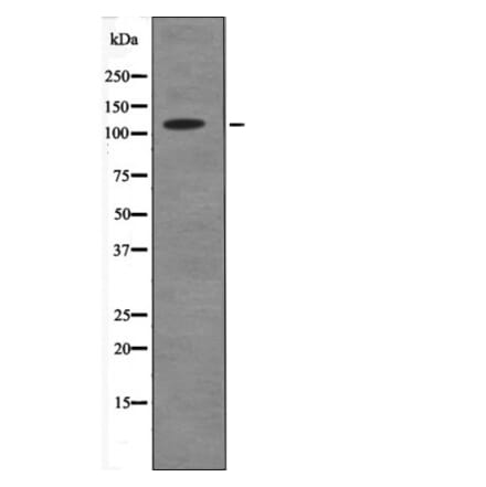 Western blot - ANKRD28 (Phospho-Ser1040) Antibody from Signalway Antibody (12571) - Antibodies.com