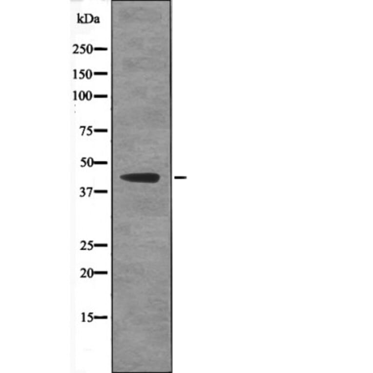 Western blot - Ataxin-3 (Phospho-Ser256) Antibody from Signalway Antibody (12574) - Antibodies.com