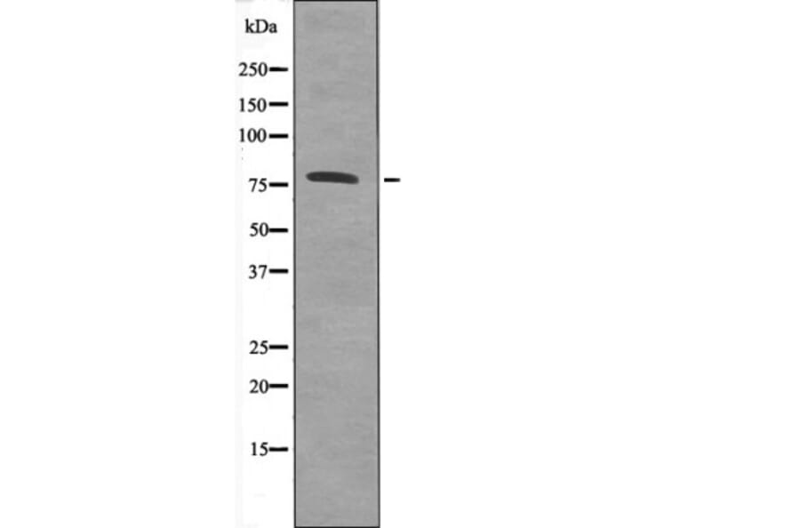 Western blot - Calpain 2 (Phospho-Ser50) Antibody from Signalway Antibody (12582) - Antibodies.com