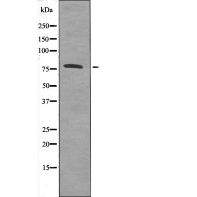 Western blot - Calpain 2 (Phospho-Ser50) Antibody from Signalway Antibody (12582) - Antibodies.com